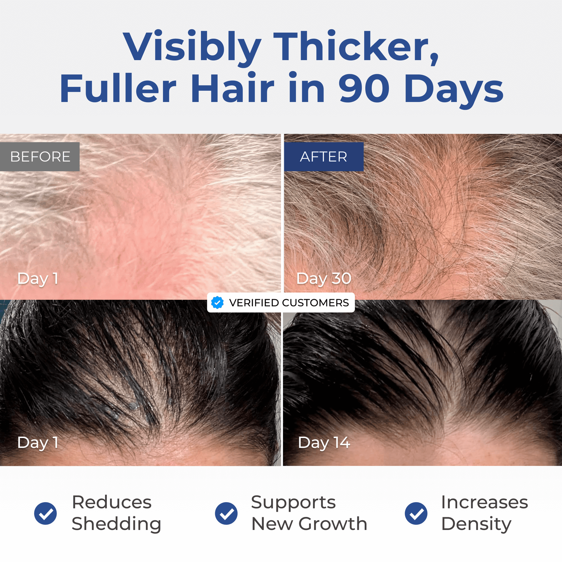 Before and after comparison of hair thickness and density with text indicating results in 90 days.