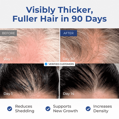 Before and after comparison of hair thickness and density with text indicating results in 90 days.