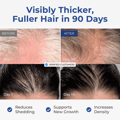 Before and after comparison of hair thickness and density with text indicating results in 90 days.