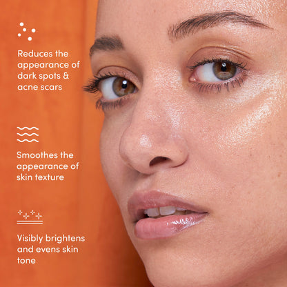 Lion Pose UNSPOTTED 4X® Acid Jelly Night Serum