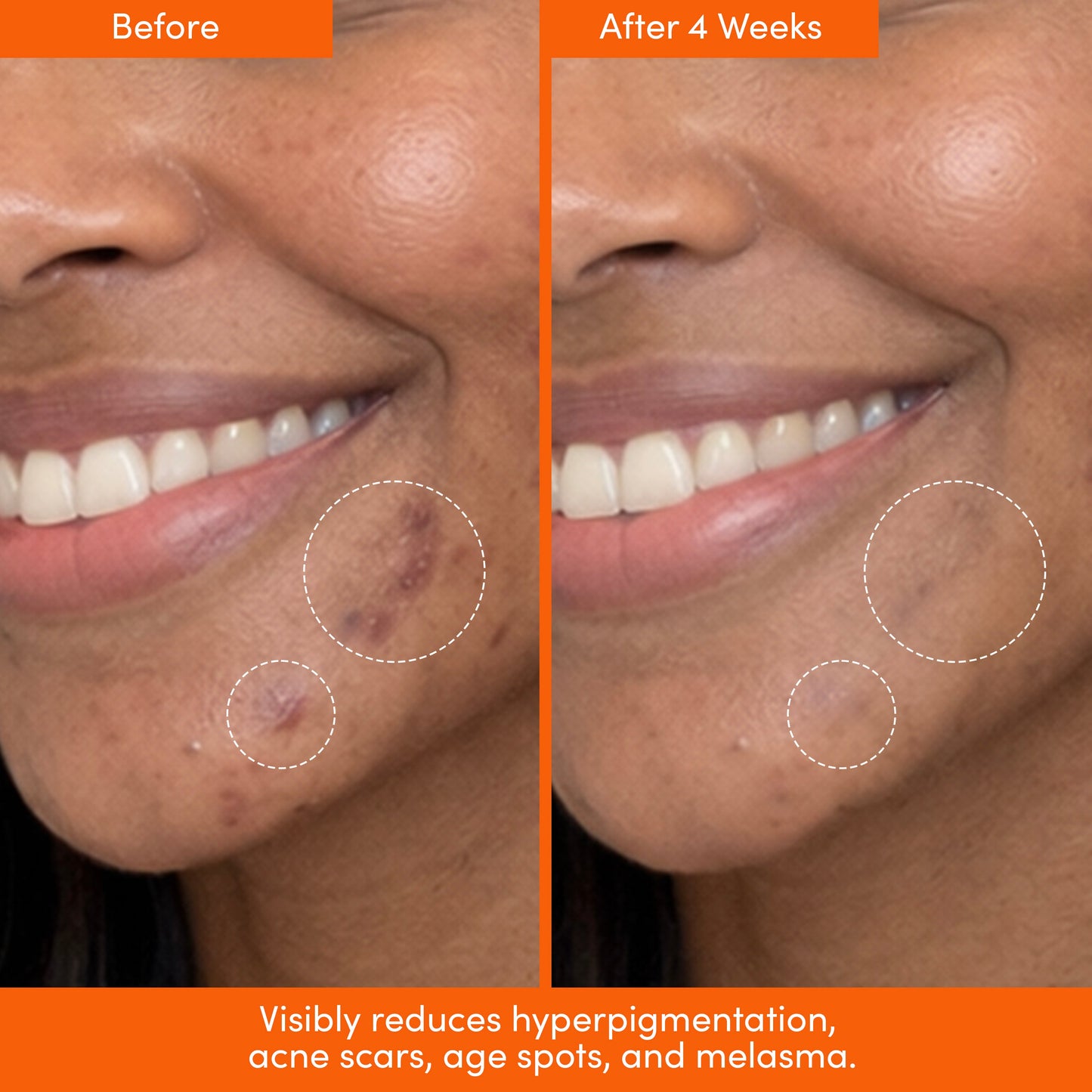 Lion Pose UNSPOTTED 4X® Acid Jelly Night Serum