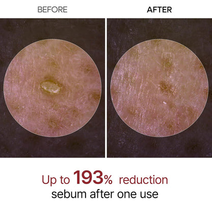 Dr. Melaxin Peel Shot Exfoliant Black Rice Ampoule