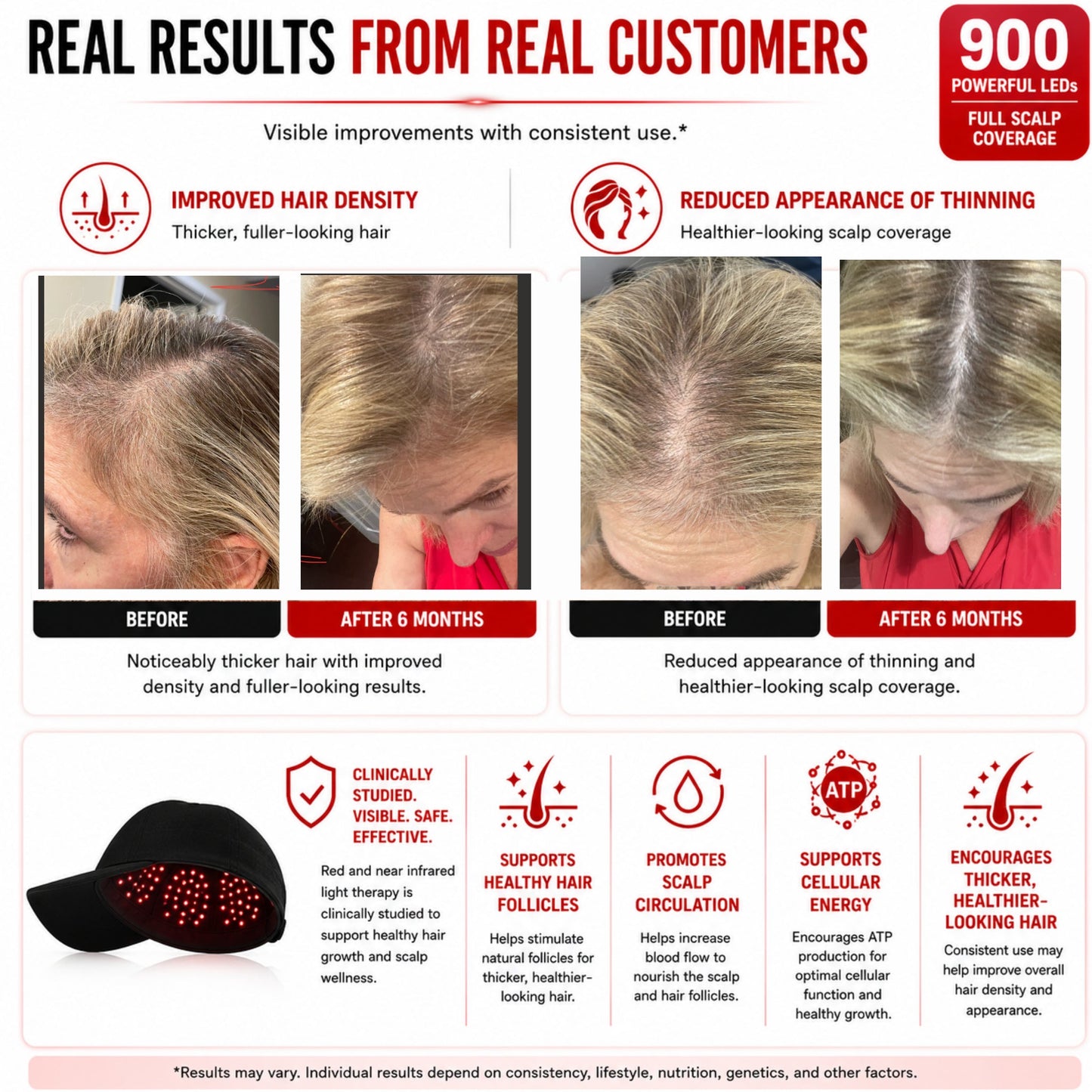 Red Light Therapy Hat