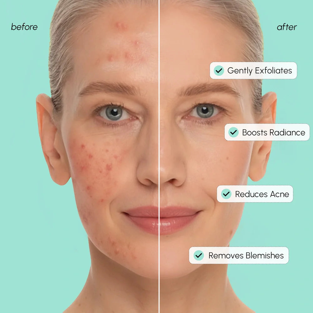 Before and after comparison of a person's face with skin care benefits listed.