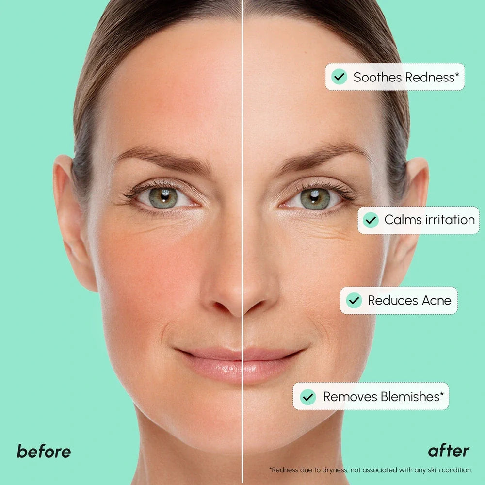Before and after comparison of a woman's face with skin care benefits listed.