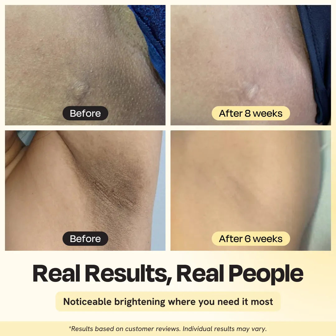 Illuminating Intimate Serum for Exfoliation & Dark Spot Correction