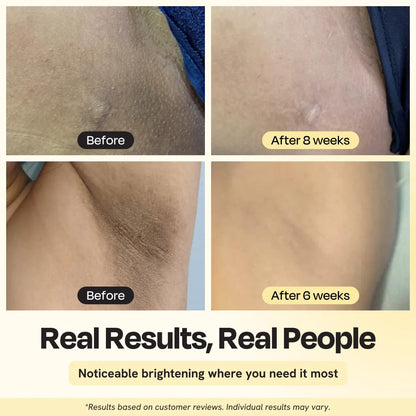 Illuminating Intimate Serum for Exfoliation & Dark Spot Correction