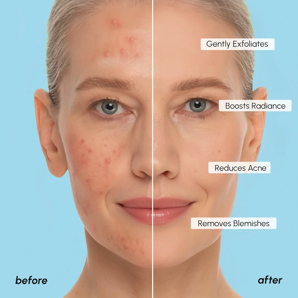 Glycolic Acid Exfoliating Pads | 200