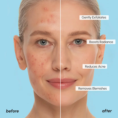 Glycolic Acid Exfoliating Pads | 200
