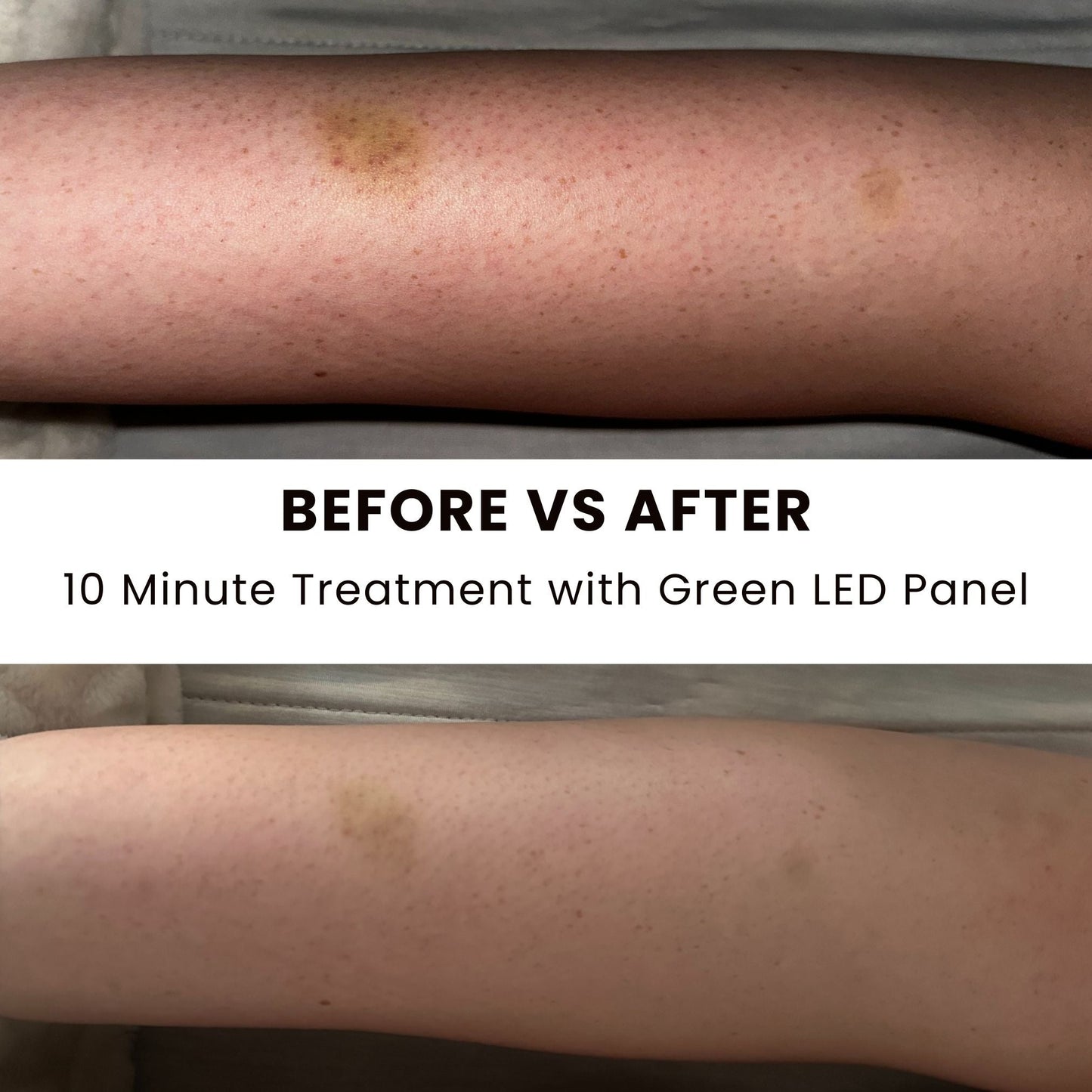 Lumara Illuminate Green Pad System for Recovery and Relaxation Support