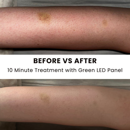 Lumara Illuminate Green Pad System for Recovery and Relaxation Support