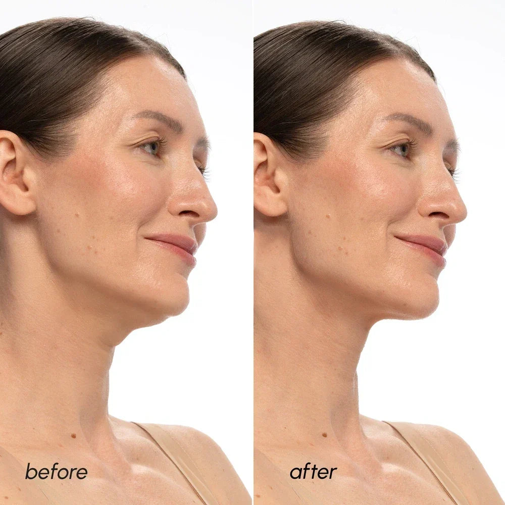 PDRN V-line Neck Lifting Mask