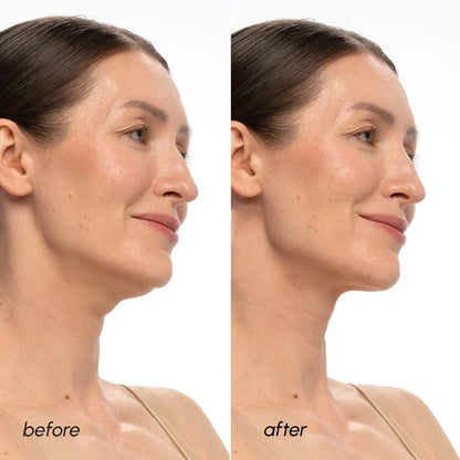PDRN V-line Neck Lifting Mask