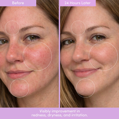 THIRST TRAP Barrier Repair Cream + SPF Ultra-Hydration Bundle