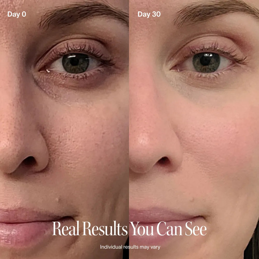 Red Light Wand (4-in-1) + Serum Kit | Solawave