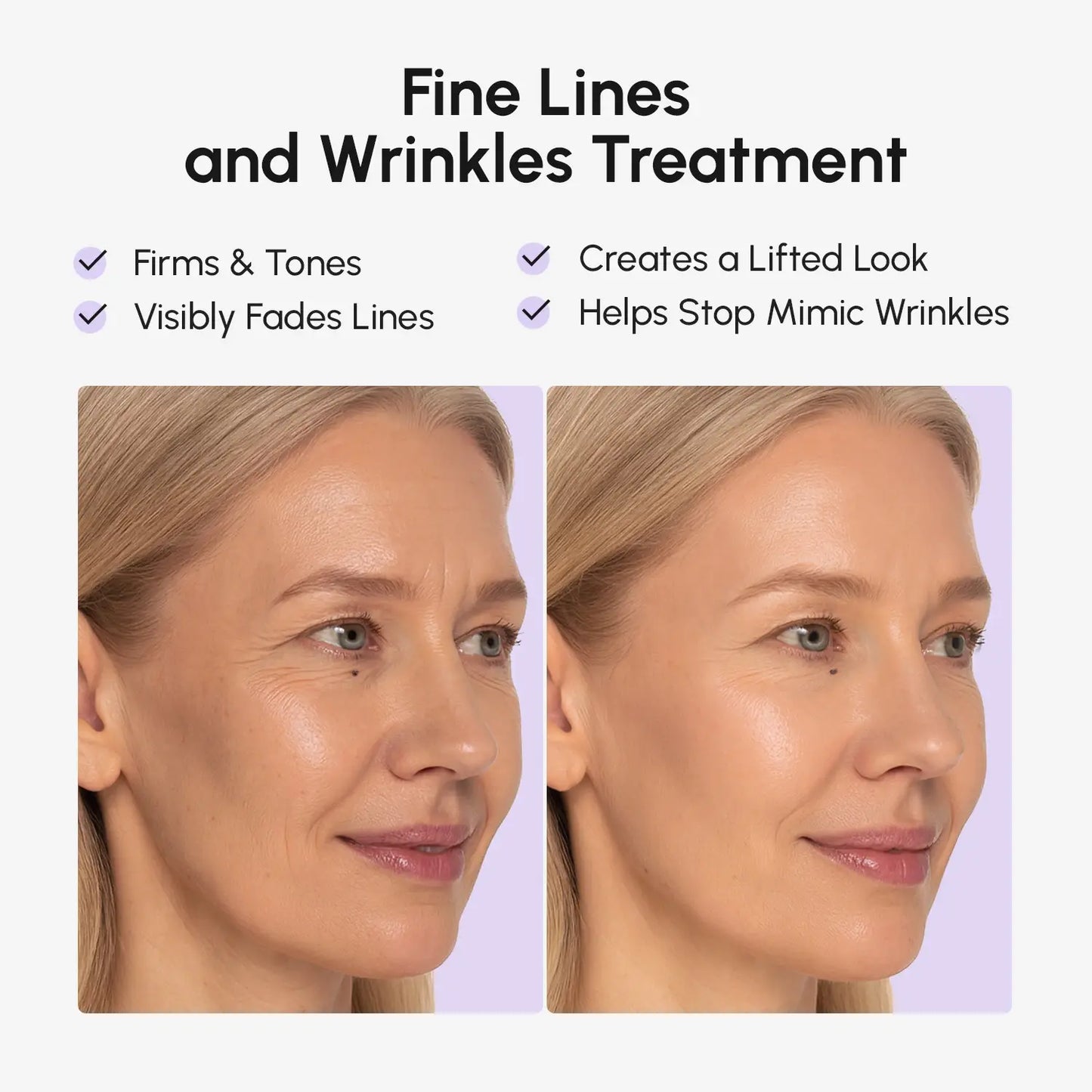 Face Life Tape Wrinkle Patches | Marée®