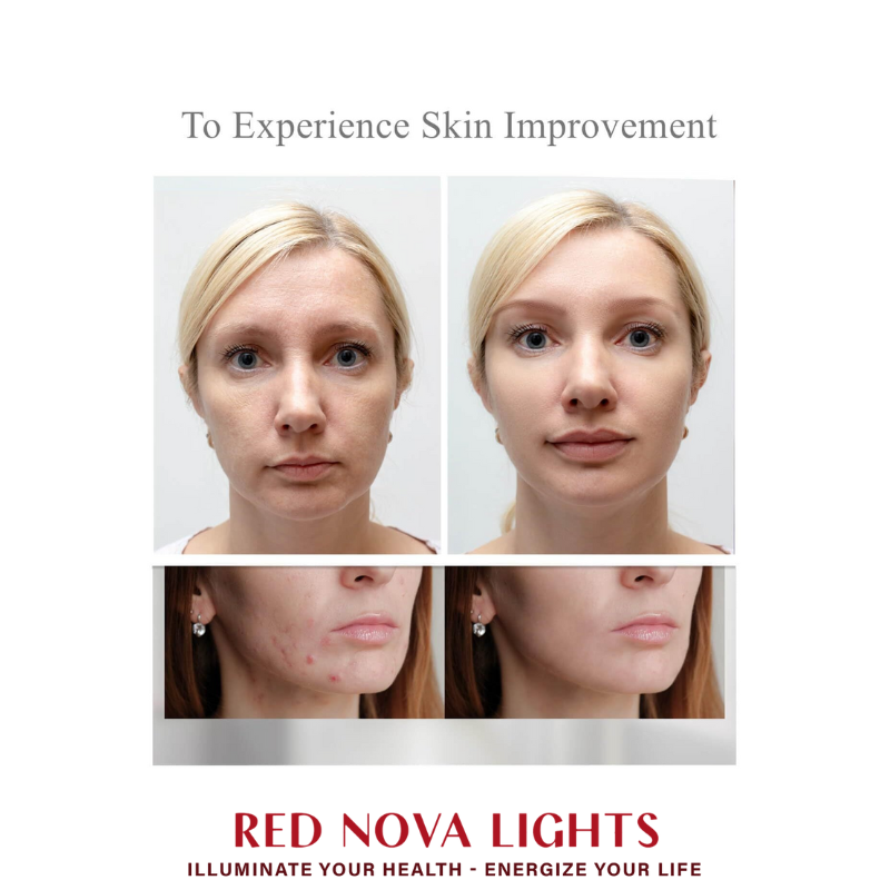 Red Nova Lights Face Mask | LED Light Support